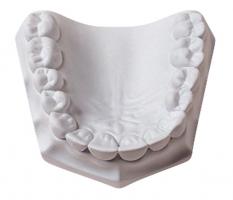 Orthodontic Stone Karton 15 kg Gips white